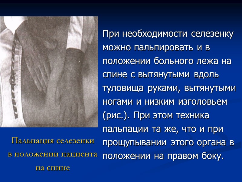 Пальпация селезенки  в положении пациента на спине  При необходимости селезенку можно пальпировать